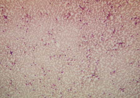 Zeiss 7Nov19f Blut Tara